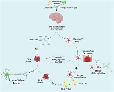 Beyond Myelination: Possible Roles of the Immune Proteasome in Oligodendroglial Homeostasis and Dysfunction